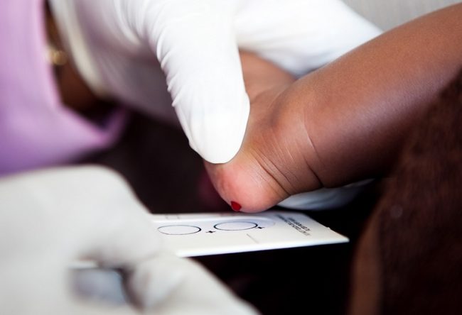hiv_aids_treatment_south_africa_support HIV/AIDS Rates in South Africa